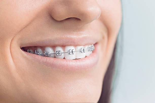 Best Full Mouth Reconstruction  in Harrisburg, IL